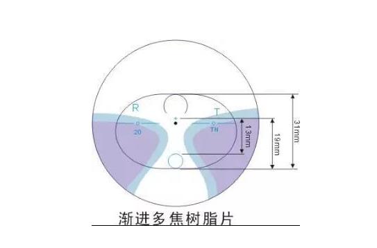 美麗島漸進多焦鏡適合的人群，需要注意的事項